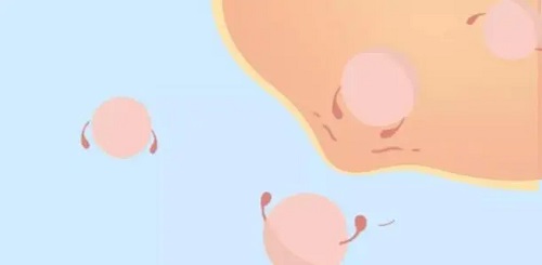 試管嬰兒移植后不能信的謠言：完全躺床休息